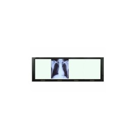 Negatoscopio cuadruple de pared con luz LED